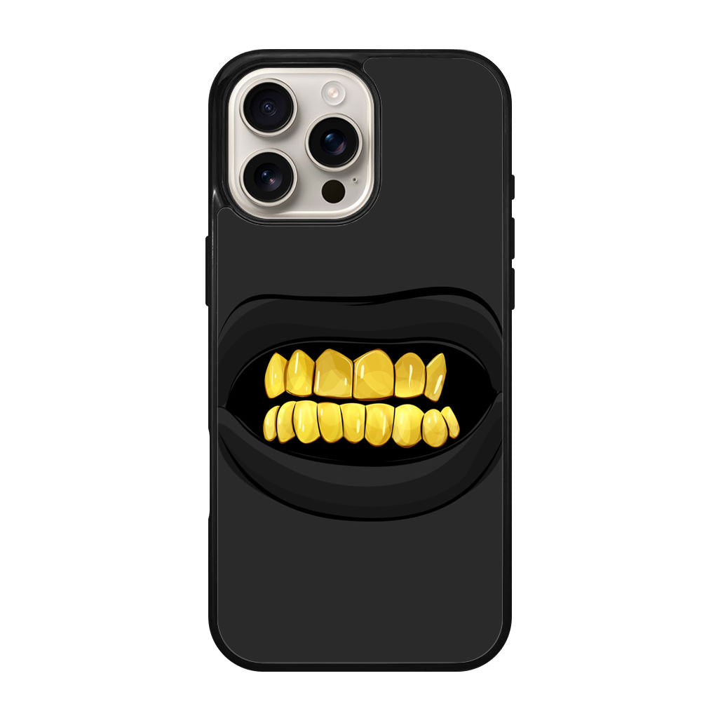 Gold Grillz iPhone 16 Pro / 16 Pro Max Case