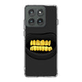 Gold Grillz Motorola Edge 2025 Case