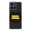 Gold Grillz Motorola Moto G 2025 Case