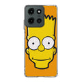 Bart Yellow Face Motorola Moto G 2025 Case
