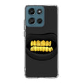 Gold Grillz Motorola Moto G Play 2026 Case