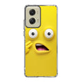 Shocked Pose Motorola Moto G Stylus 5G 2024 Case