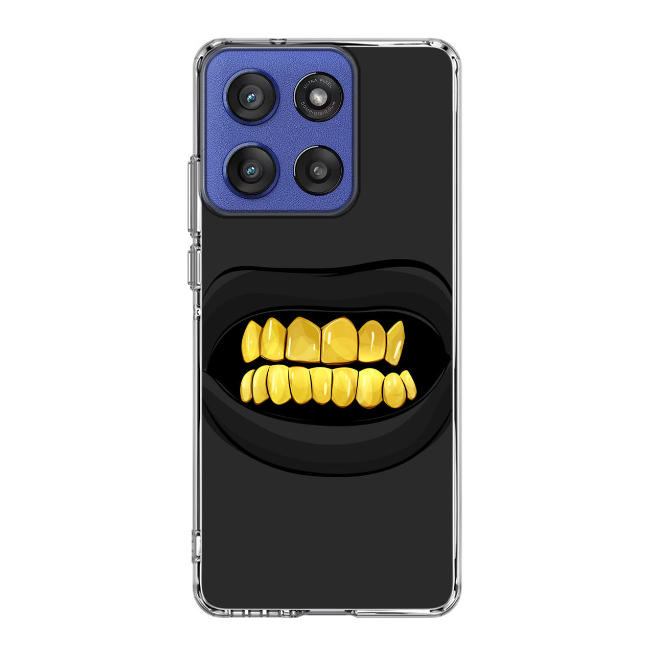 Gold Grillz Motorola Moto G Stylus 2025 Case