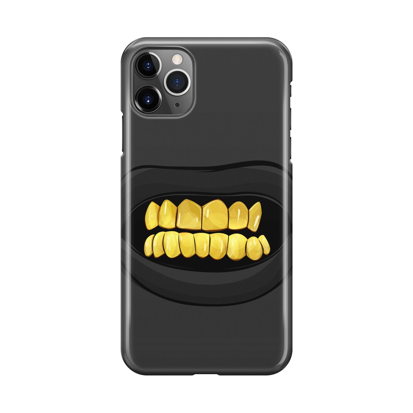 Gold Grillz iPhone 11 Pro Case