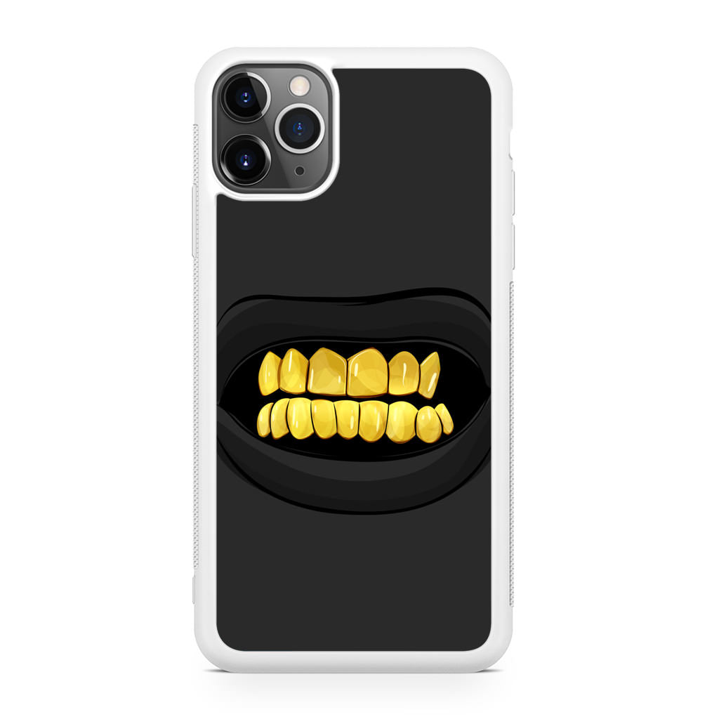 Gold Grillz iPhone 11 Pro Case