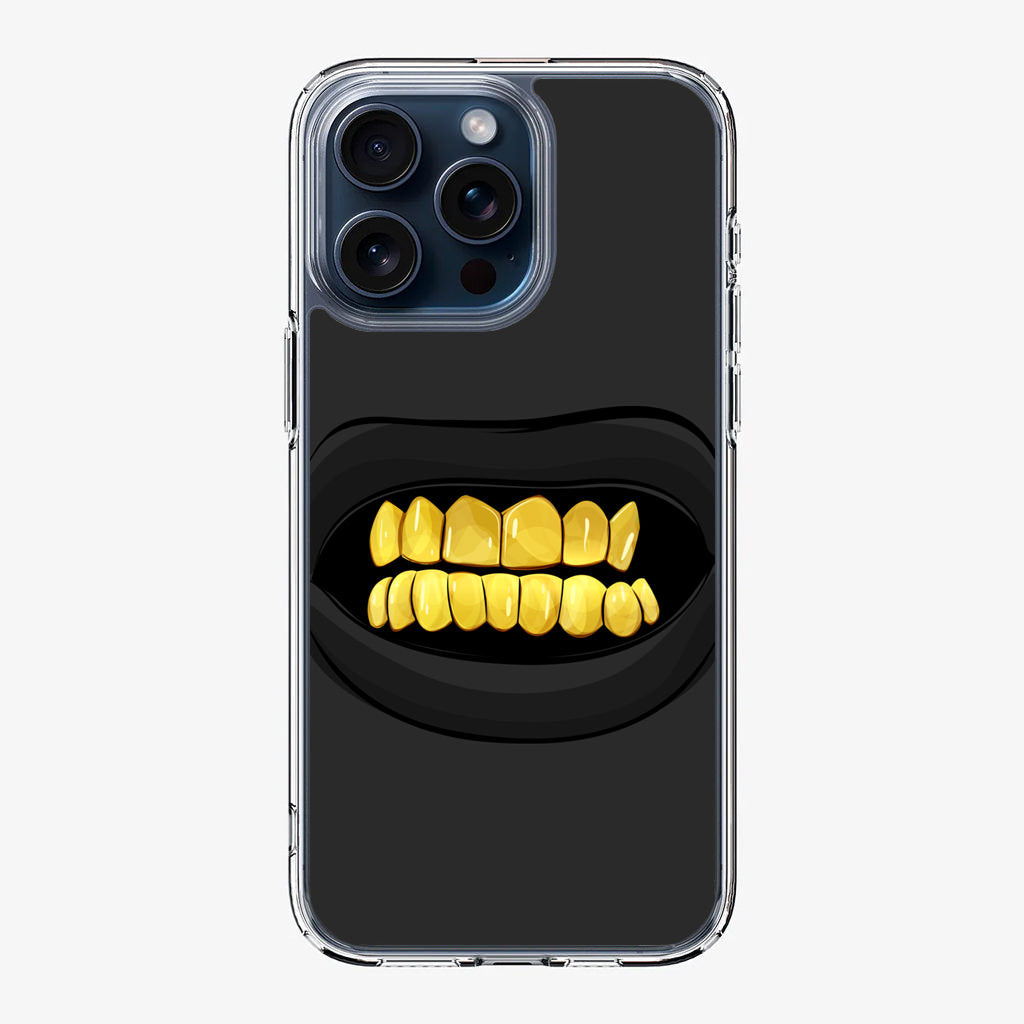 Gold Grillz iPhone 15 Pro / 15 Pro Max Case